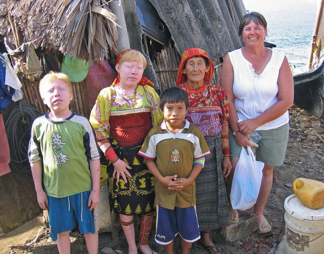 «Дети луны» - уникальные индейцы-альбиносы Панамы