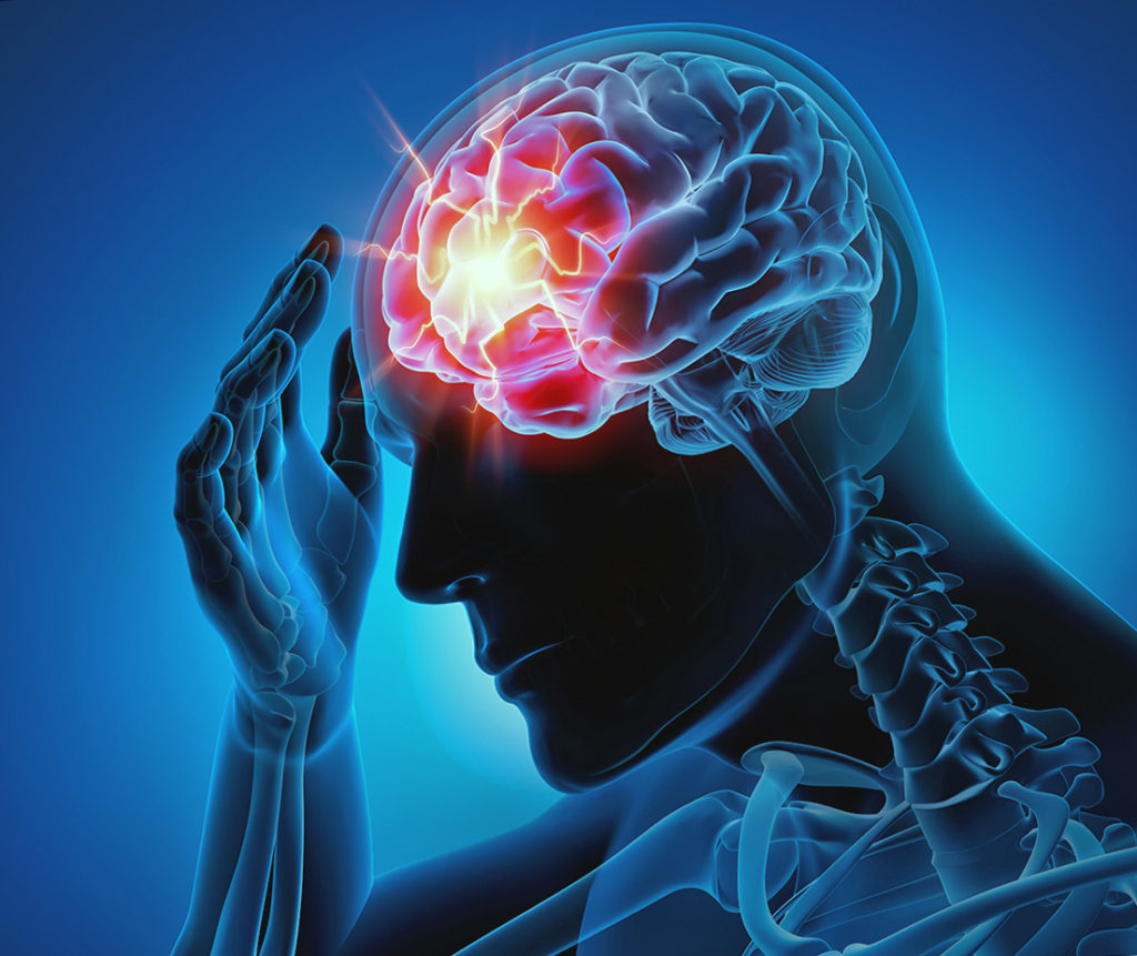 Эпилепсия и мигрени генетически взаимосвязаны